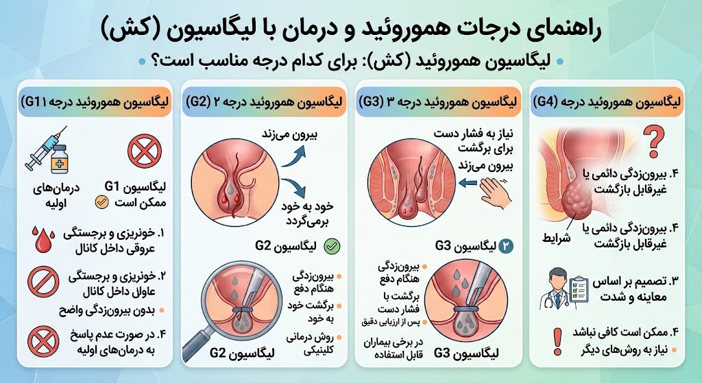 درجات لیگاسون هموروئید