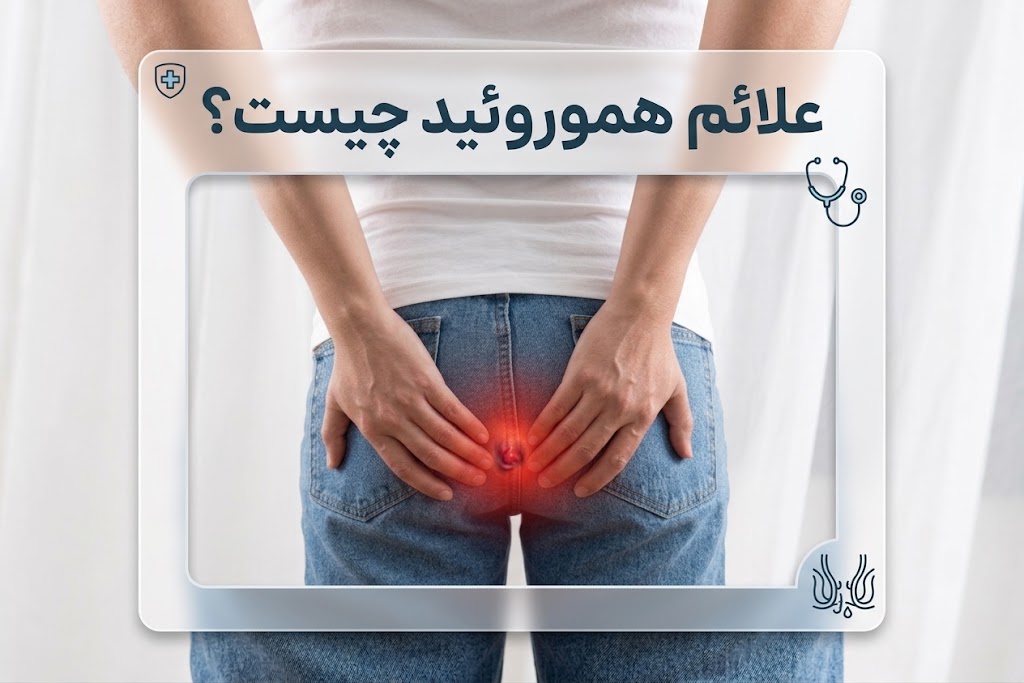 علائم بواسیر یا هموروئید؛ علائم داخلی، خارجی و تشخیص